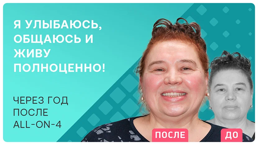 Видео отзыв о новом уровне жизни с красивыми зубами