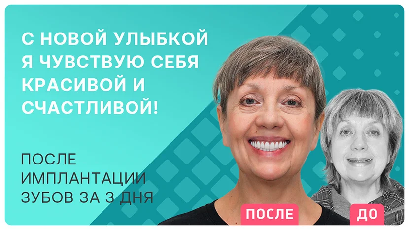 Видео отзыв через три с половиной года после имплантации