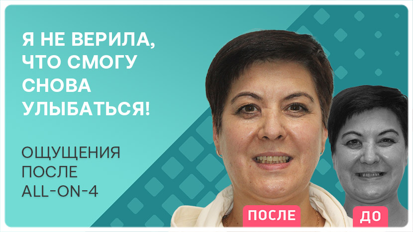 Видео отзыв пациентки после all-on-4 в клинике Smile-at-Once