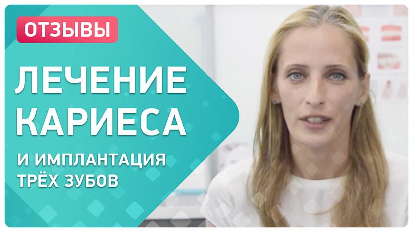 Видео-отзыв лечение кариеса и имплантация 3 зубов