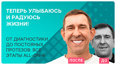 Видео - Зубы за 1 день: история Бурдюг Дмитрия – победителя 3 сезона акции
