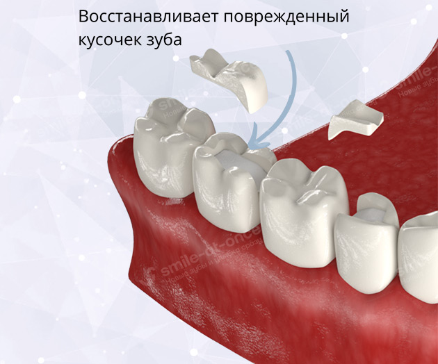 Восстановительная вкладка