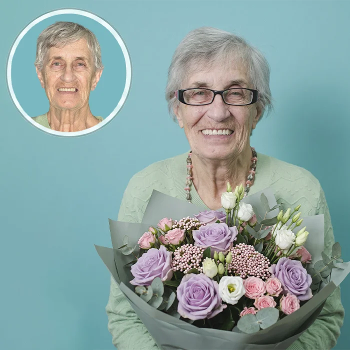 Восстановление всех зубов для пациента 60+