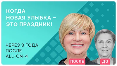 Видео - Отзыв пациентки через 3 года после имплантации all-on-4