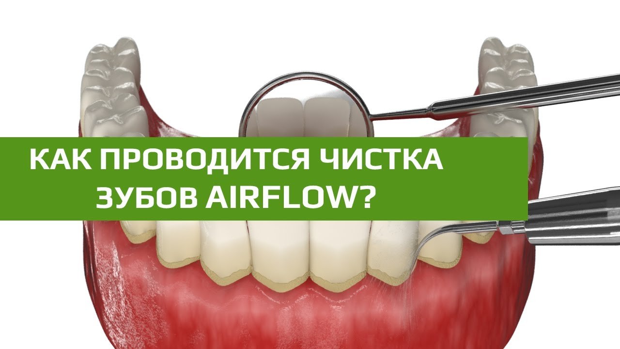 Видео о чистке зубов Air Flow