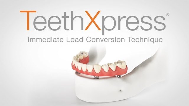 Видео об имплантации TeethXpress