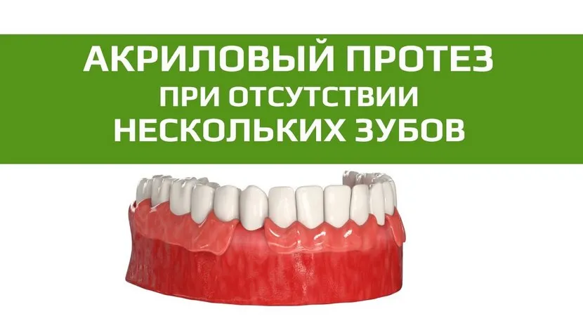 Видео об акриловых зубных протезах 