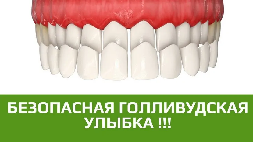 Видео о люминирах на зубы