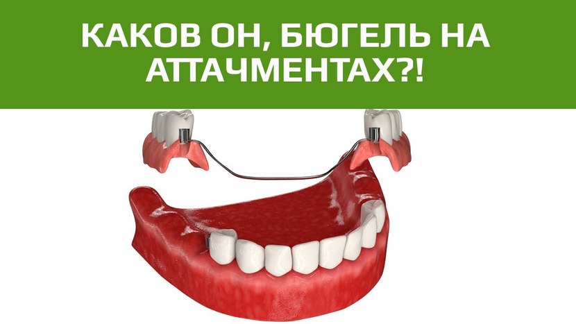 Видео о лечении гранулемы зуба