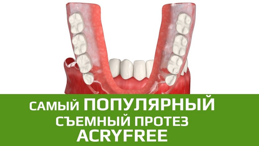Видео о зубных протезах Акри-Фри