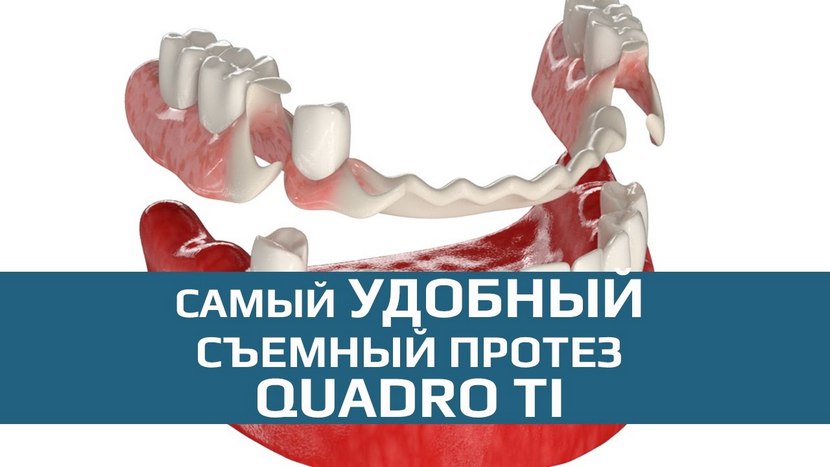 Видео о зубных протезах Квадротти