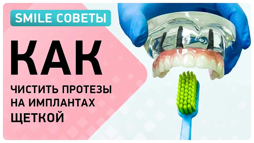 Гигиена протезов на имплантах как пользоваться зубной щеткой