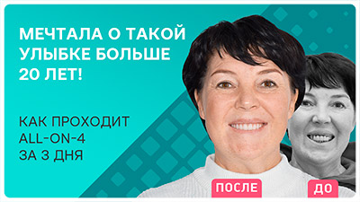 Видео - Эмоции после All-on-4 за 3 дня: история Инны Соповой