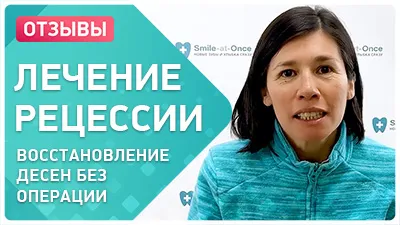 Видео - Устранение рецессии десны без операции: отзыв о лечении и имплантации зубов