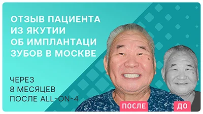 Видео - Отзыв через 8 месяцев после имплантации ALL-ON-4