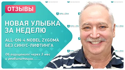 Видео - Новая улыбка за неделю: отзыв о скуловой имплантации Nobel Zygoma