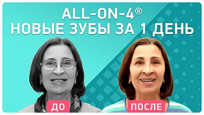 Видео - Зубы за 1 день по протоколу All-on-4: «все классно и без боли!»