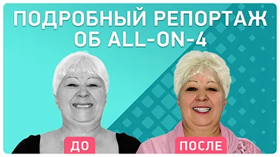 Видео - Новые зубы за 1 день. Подробный репортаж о том, как проходит имплантация ALL-ON-4