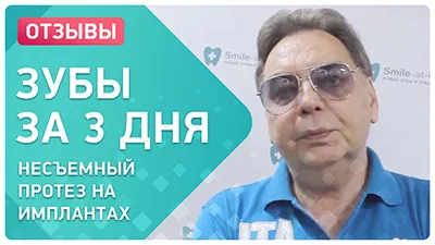 Видео - Комплексная имплантация за 3 дня. Отзыв пациента сразу после имплантации зубов