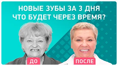 Видео - Комплексная имплантация за 3 дня. Опыт пациентки: что будет через 2 года?