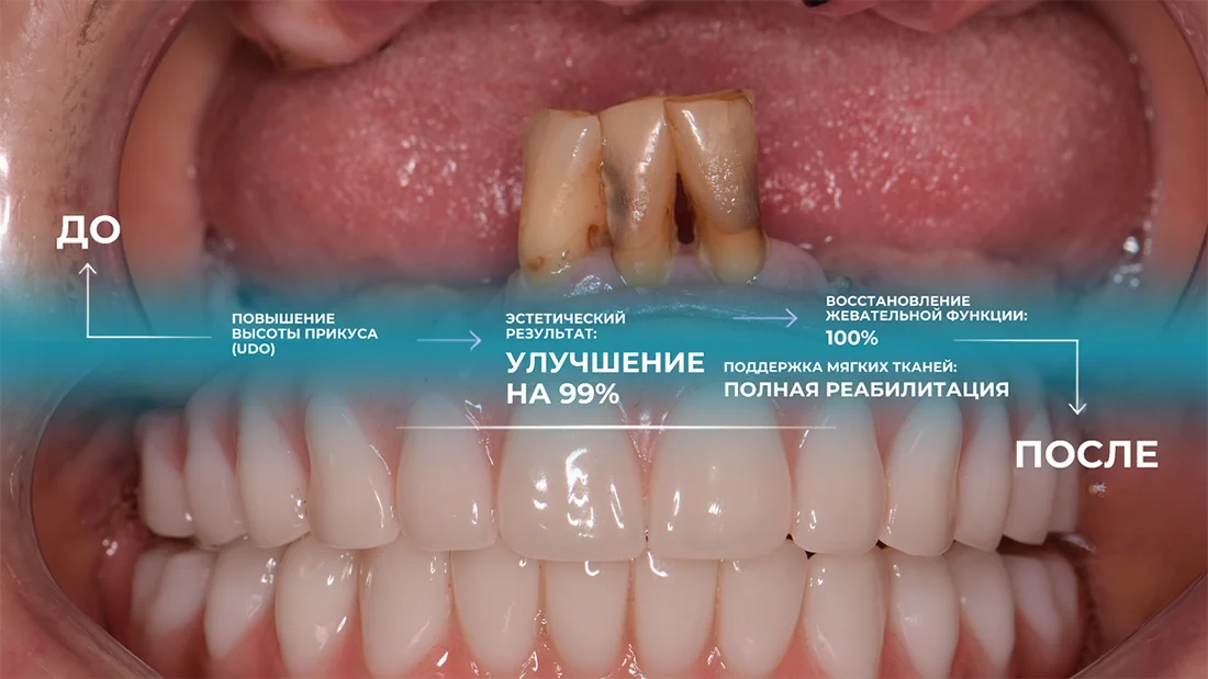 Результат ДО и ПОСЛЕ