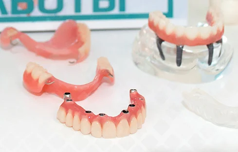 10 частых вопросов стоматологу о протезировании зубов и ответы на них