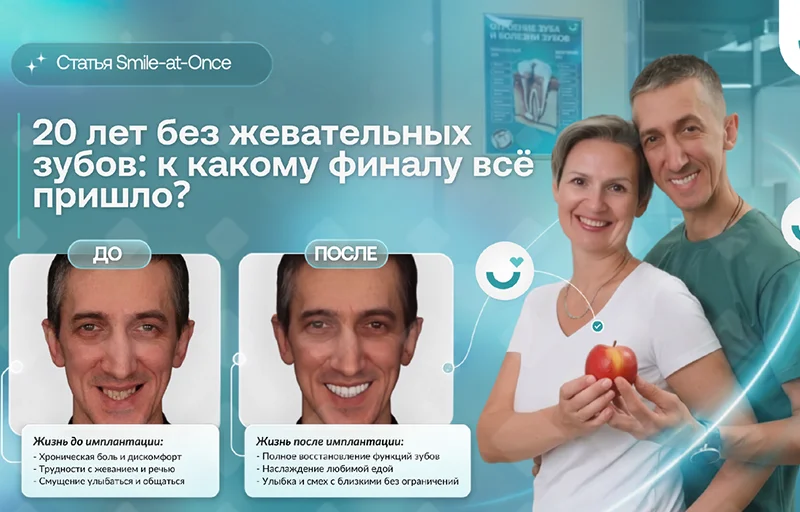 20 лет без жевательных зубов