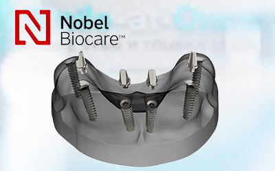 Конструкция из 6-ти имплантов Nobel Biocare – протокол All-on-6