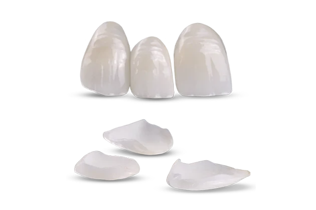 Винир E-max с эстетической облицовкой