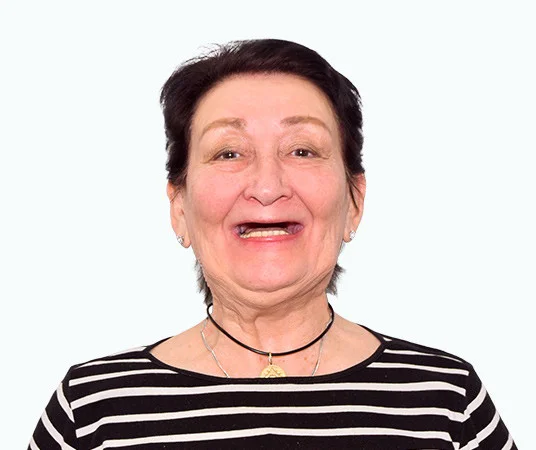 до имплантации Татьяна Леонидовна