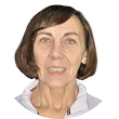 Вера Ивановна до проведения имплантации зубов