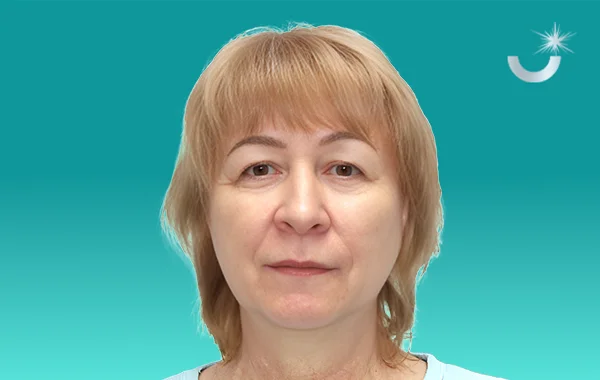 Имплантация всех зубов all-on-4 Nobel Biocare до