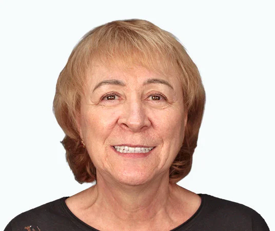 Фото после комплексной имплантации зубов