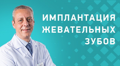 Видео о восстановлении жевательных зубов имплантами