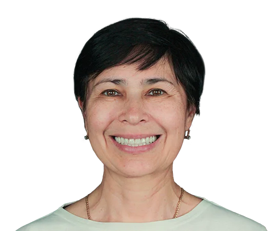 После скуловой имплантации всех зубов ALL-ON-4 Nobel Zygoma