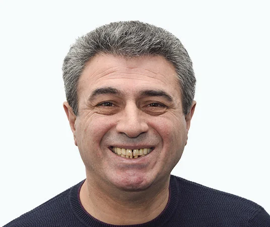 Фото до комплексной имплантации зубов