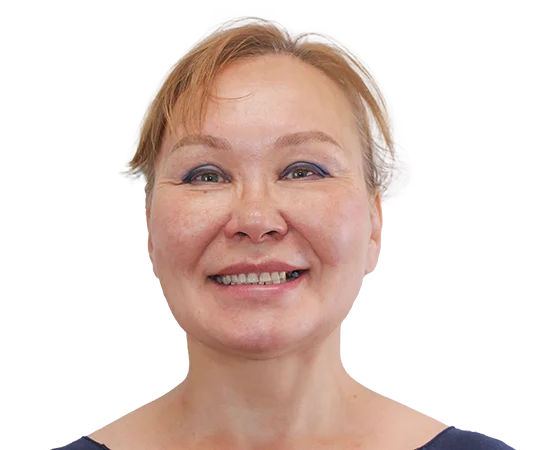 До имплантации зубов Straumann и виниров