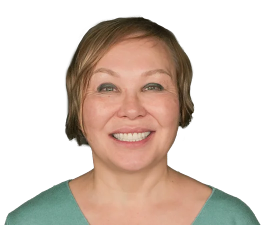 После имплантации зубов Straumann и виниров