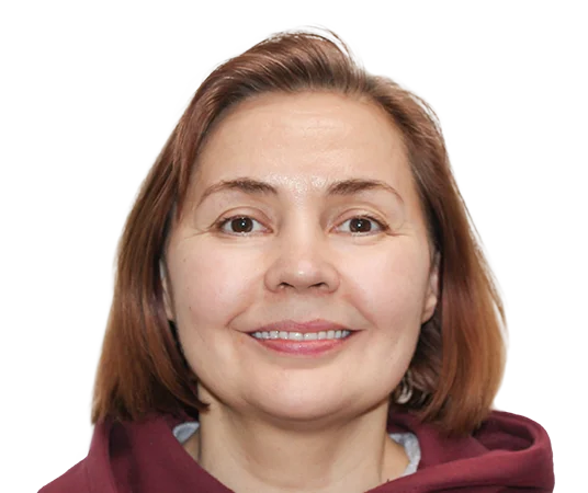 После имплантации зубов методом All-on-4