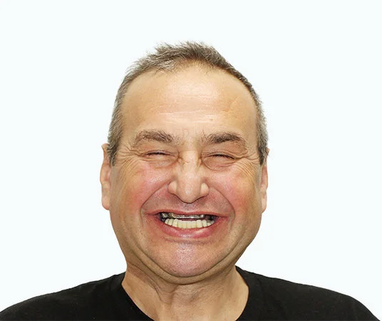 До восстановления зубов имплантацией