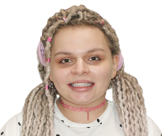 После имлантации взамен съемных зубных протезов