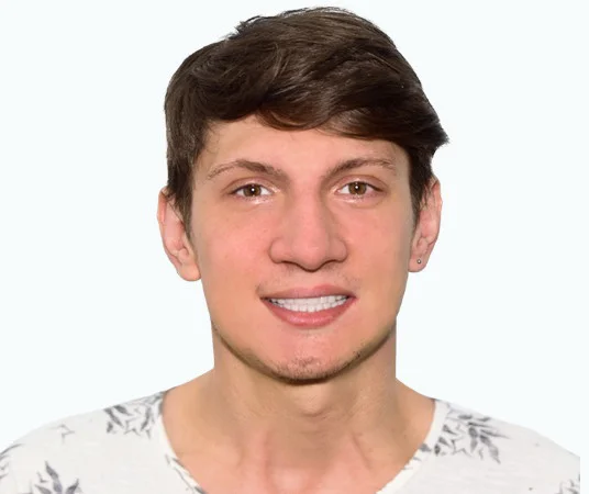 Состояние пациента после имплантации зубов