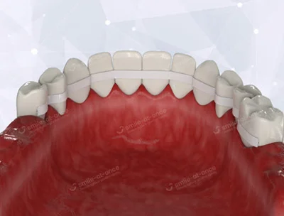 Проблема: Подвижность зубов