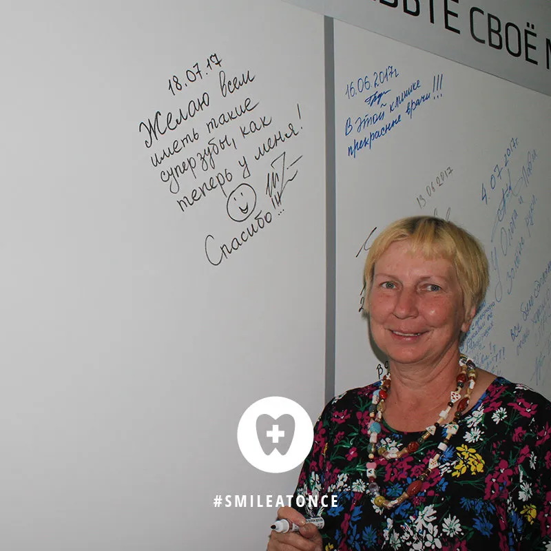 После имплантации зубов - фото пациента