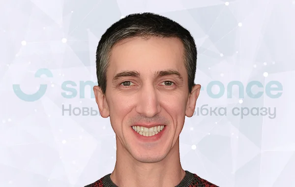 Имплантация зубов all-on-4 Nobel Biocare «зубы за 1 день» после