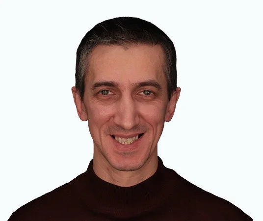 Полное восстановление зубов all-on-4 до