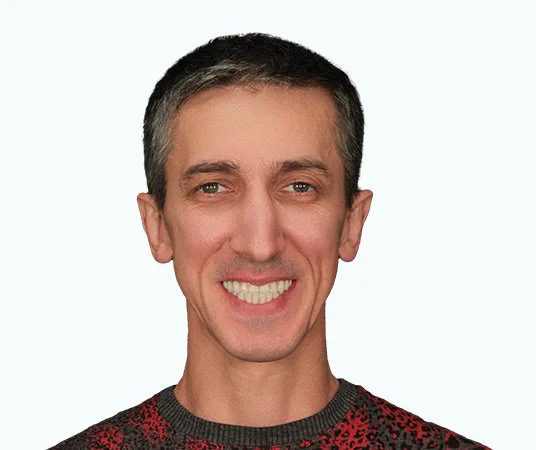 Полное восстановление зубов all-on-4 после