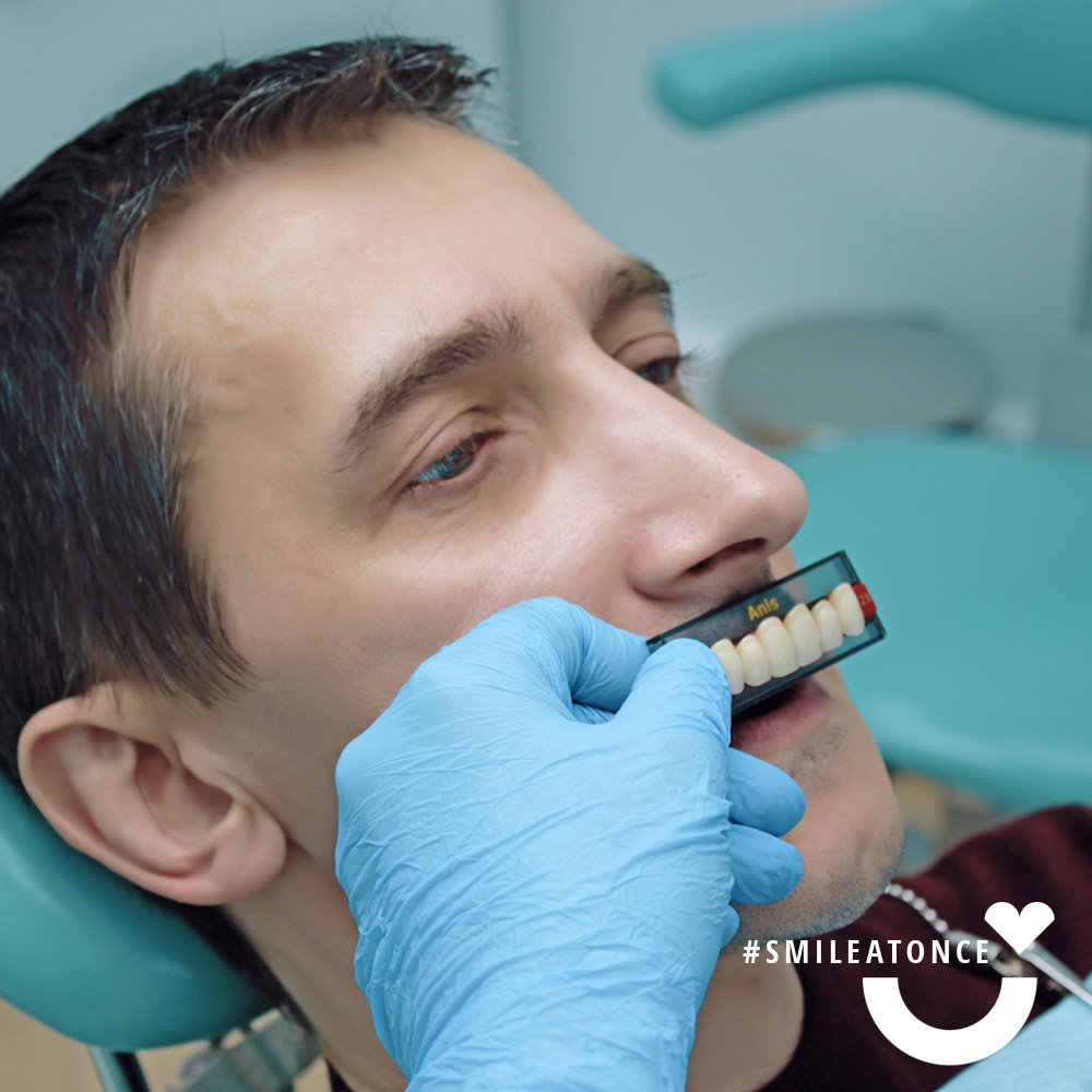 Подбор формы и цвета зубов