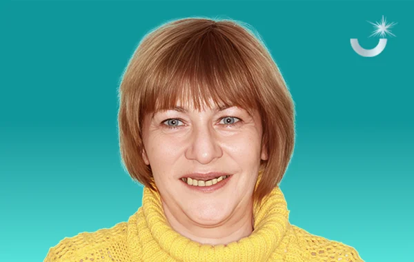 Комплексное восстановление всех зубов до