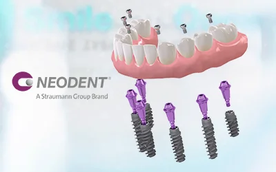 Конструкция из 6-ти имплантов Neodent